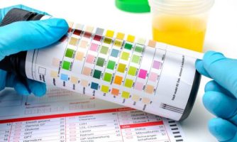 Promising urine test could improve early detection and clinical management of bladder cancer: IARC Evidence Summary Brief No. 3