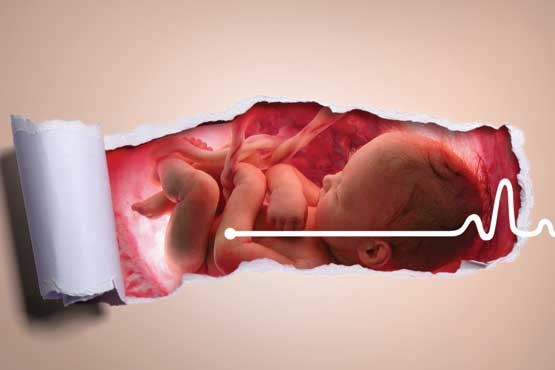 در کنفرانس پژوهشگاه ابن سینا بررسی می شود: تاثیر میزان خون رحمی در سقط های مکرر
