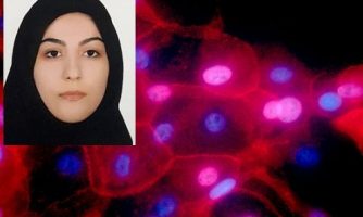تشخیص غیرمخرب توده‌های سرطانی بافت پستان با ماموگراف نوری محققان ایرانی