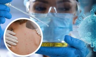 تامین کیت‌های غربالگری آبله میمونی در انستیتو پاستور/توزیع کیت‌های اولیه در آزمایشگاه‌های منتخب
